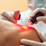 Medical professional using a red laser device on patient's shoulder, clinical setting with warm lighting, close-up of the therapeutic laser beam interaction with skin
